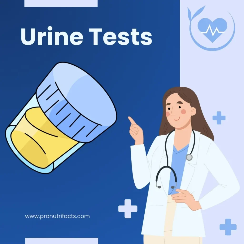 Urine analysis for vitamins